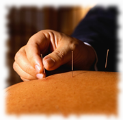 Acupuncture treatment